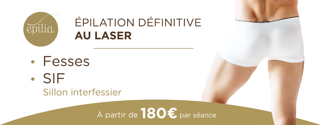 epilation laser femmes sif homme arlon