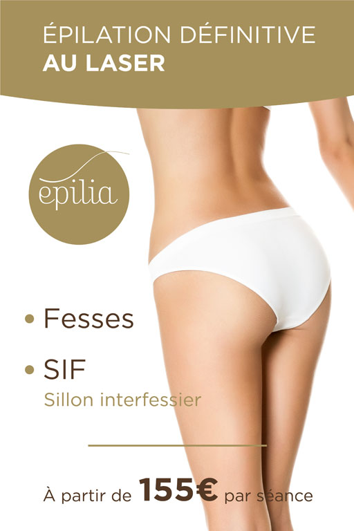 epilation laser fesses sif arlon mob