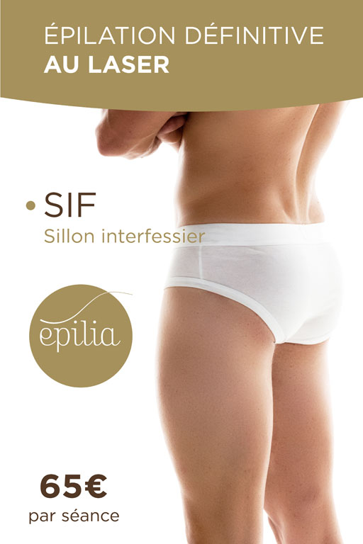epilation laser sif homme arlon mob