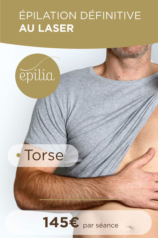 epilation laser torse arlon mob